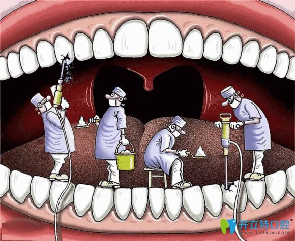 自己在家怎樣殺牙神經?牙齒抽神經過程疼嗎?多少錢一顆