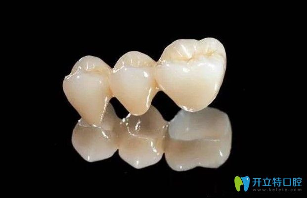 干貨！國產(chǎn)全瓷牙價格是多少?國產(chǎn)全瓷牙和進口區(qū)別是什么