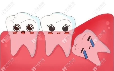 玉林藍天口腔拔智齒怎么收費?友友們較關(guān)心的價格表來啦!